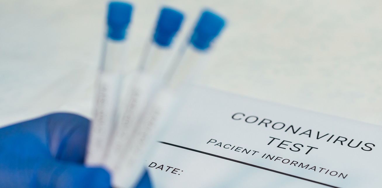 افزایش مدت اعتبار آزمایش PCR برای سفر به مالدیو به 96 ساعت